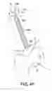 Fig. 07 - Methods and devices for accessing and retracting a capsule of a joint