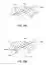 Fig. 49 - Methods and devices for accessing and retracting a capsule of a joint