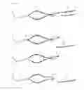Fig. 06 - Suture thread