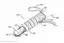 Fig. 01 - Knotless suture anchor