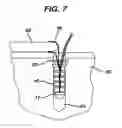 Fig. 07 - Knotless suture anchor