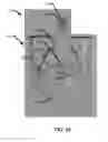 Fig. 20 - Devices, systems, and methods for attaching soft tissue to bone tissue