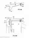 Fig. 09 - Apparatus and method for tissue closure