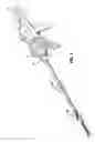 Fig. 02 - Surgical stapling device