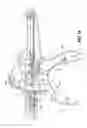 Fig. 10 - Surgical stapling device