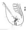 Fig. 28 - Surgical stapling loading unit having articulating jaws