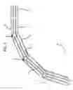 Fig. 04 - Articulating steerable clip applier for laparoscopic procedures
