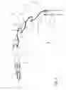 Fig. 06 - Articulating steerable clip applier for laparoscopic procedures