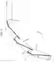 Fig. 08 - Articulating steerable clip applier for laparoscopic procedures