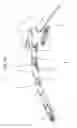 Fig. 12 - Articulating steerable clip applier for laparoscopic procedures