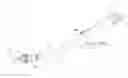 Fig. 01 - Circular stapler