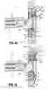 Fig. 22 - Anvil assembly delivery system
