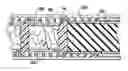 Fig. 01 - Articulation joint for apparatus for endoscopic procedures