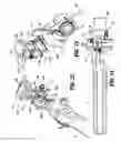 Fig. 09 - Endoscopic reposable surgical clip applier