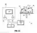 Fig. 30 - Endoscopic reposable surgical clip applier