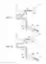 Fig. 28 - Clot retrieval system
