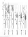 Fig. 33 - Clot retrieval system