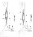 Fig. 48 - Clot retrieval system