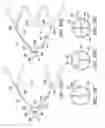 Fig. 68 - Clot retrieval system