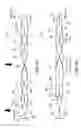 Fig. 96 - Clot retrieval system