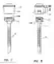 Fig. 06 - Surgical access port