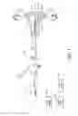 Fig. 07 - POLYPECTOMY SYSTEMS, DEVICES, AND METHODS