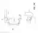 Fig. 41 - POLYPECTOMY SYSTEMS, DEVICES, AND METHODS