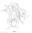 Fig. 03 - Spinal implant system and method