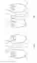 Fig. 05 - Spinal implant system and method