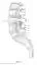 Fig. 07 - Spinal implant system and method