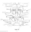 Fig. 10 - Spinal implant system and method