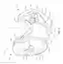 Fig. 13 - Spinal implant system and method