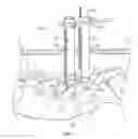 Fig. 02 - Percutaneous vertebral stabilization system