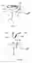 Fig. 05 - Joint repair system