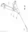 Fig. 11 - Articulating osteotome with cement delivery channel