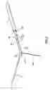 Fig. 08 - METHODS AND DEVICES FOR CRYOGENIC CAROTID BODY ABLATION