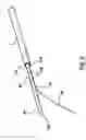 Fig. 09 - METHODS AND DEVICES FOR CRYOGENIC CAROTID BODY ABLATION