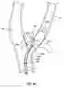 Fig. 28 - METHODS AND DEVICES FOR CRYOGENIC CAROTID BODY ABLATION