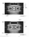 Fig. 07 - Methods and apparatus for intravascularly-induced neuromodulation