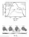 Fig. 07 - Patient-specific virtual intervention laboratory to prevent stroke