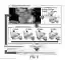 Fig. 08 - Patient-specific virtual intervention laboratory to prevent stroke