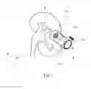 Fig. 08 - Method and system for interactive grid placement and measurements for lesion removal