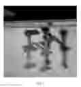 Fig. 07 - Method and fixture for guided pedicle screw placement