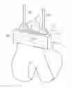 Fig. 01 - Guidance for surgical procedures