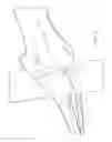 Fig. 08 - Guidance for surgical procedures
