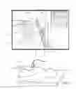 Fig. 04 - Medical device navigation using a virtual 3D space