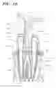 Fig. 09 - Apparatus, methods, and compositions for endodontic treatments
