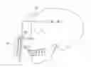 Fig. 01 - Orthodontic device