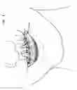Fig. 02 - Bracket extension system
