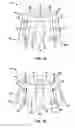 Fig. 06 - Removable and adjustable abutment devices and methods of operation thereof